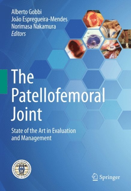 Norimasa Nakamura, Joao Espregueira-Mendes, Alberto Gobbi - Patellofemoral Joint, E-bok