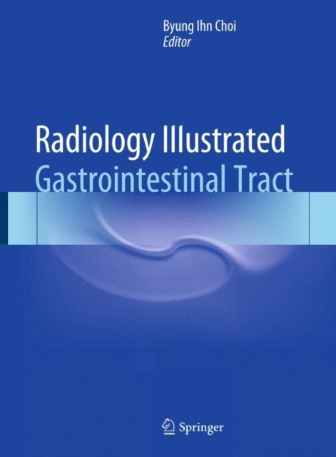Byung Ihn Choi - Radiology Illustrated: Gastrointestinal Tract, E-bok