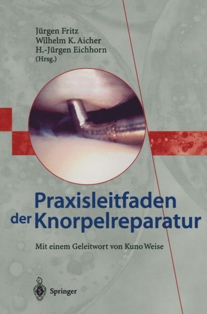 H.-Jurgen Eichhorn, Wilhelm K. Aicher, Jurgen Fritz - Praxisleitfaden der Knorpelreparatur, E-bok