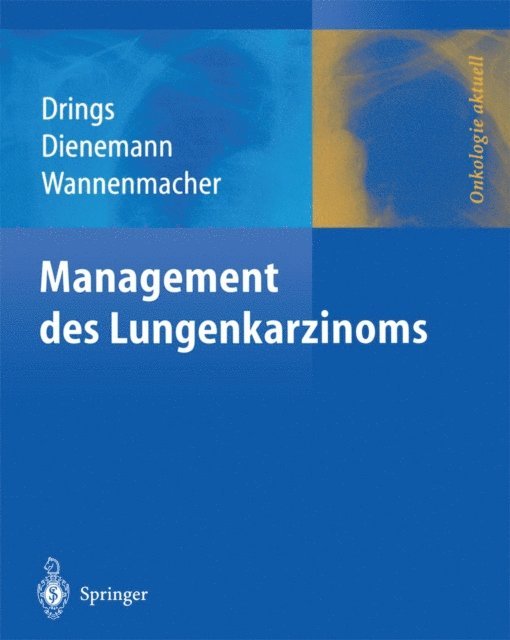 Michael Wannenmacher, Hendrik Dienemann, Peter Drings - Management des Lungenkarzinoms, E-bok