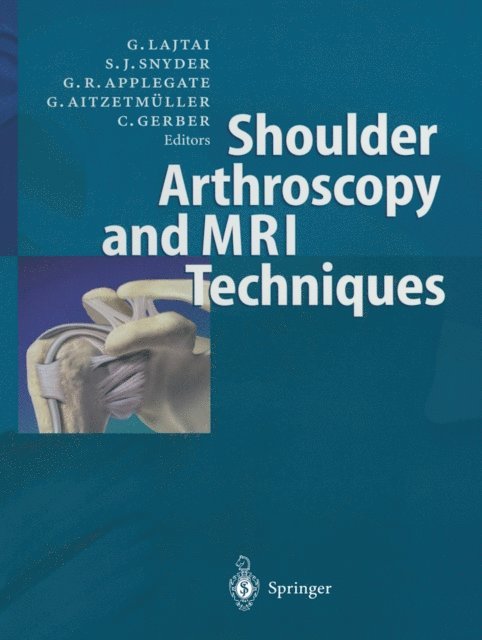 Christian Gerber, Gernot Aitzetmuller, Gregory Applegate, Stephen J. Snyder, Georg Lajtai - Shoulder Arthroscopy and MRI Techniques, E-bok