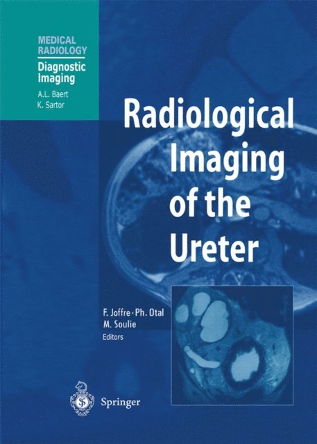 Michel Soulie, Philippe Otal, Francis Joffre - Radiological Imaging of the Ureter, E-bok