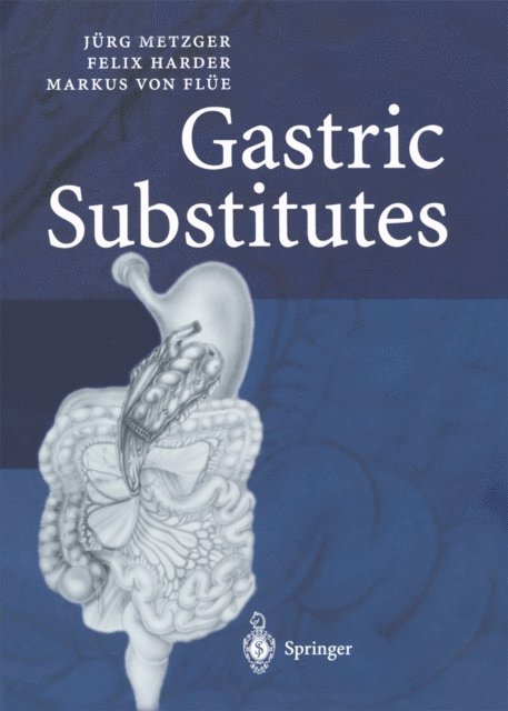 Markus von Flue, Felix Harder, Jurg Metzger - Gastric Substitutes, E-bok
