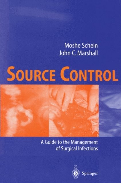 John C. Marshall, Moshe Schein - Source Control, E-bok