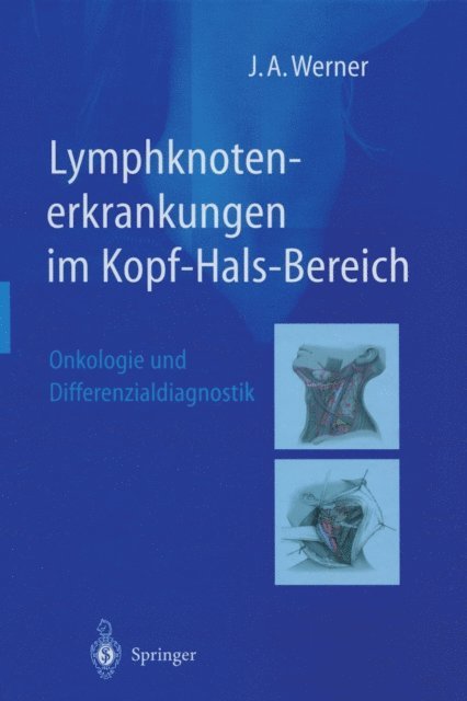 Jochen A. Werner - Lymphknotenerkrankungen im Kopf-Hals-Bereich, E-bok