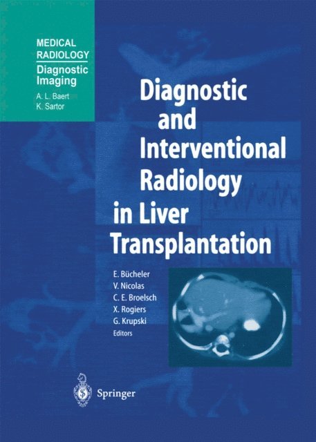 G. Krupski, X. Rogiers, C.E. Broelsch, V. Nicolas, E. Bucheler - Diagnostic and Interventional Radiology in Liver Transplantation, E-bok