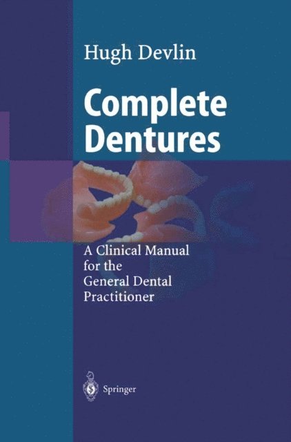 Hugh Devlin - Complete Dentures, E-bok