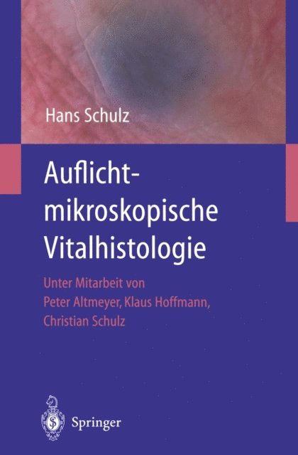 Hans Schulz - Auflichtmikroskopische Vitalhistologie, E-bok