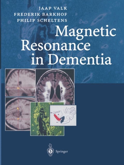 Philip Scheltens, Nick C. Fox, Jaap Valk, Frederik Barkhof - Magnetic Resonance in Dementia, E-bok