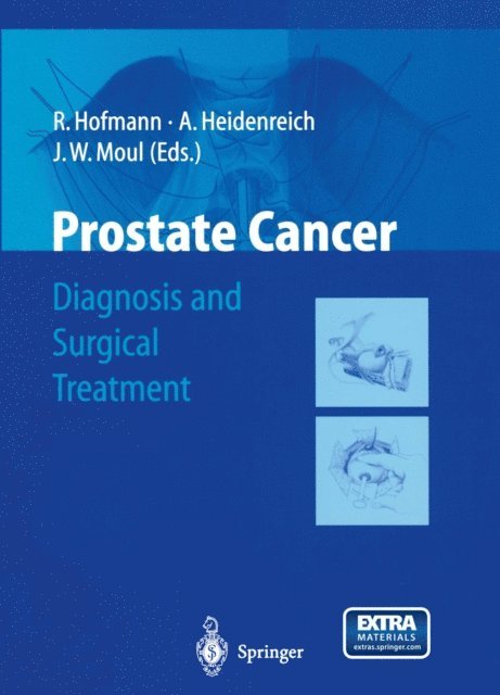 Judd W. Moul, Axel Heidenreich, R. Hofmann - Prostate Cancer, E-bok