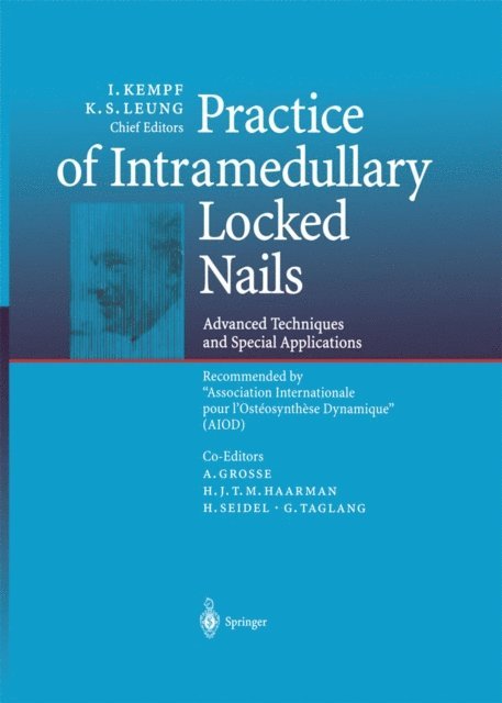 K.S. Leung, I. Kempf - Practice of Intramedullary Locked Nails, E-bok