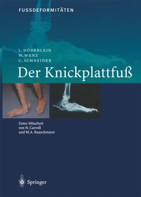U. Schneider, W. Wenz, L. Doderlein - FussdeformitÄten, E-bok