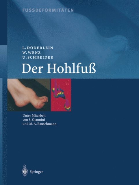 U. Schneider, W. Wenz, L. Doderlein - Fussdeformitäten, E-bok