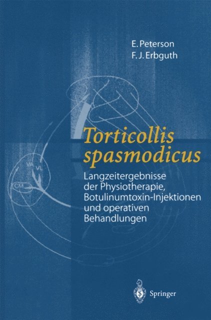 F.J. Erbguth, E. Peterson - Torticollis spasmodicus, E-bok. Tillgänglighet: Lägg i varukorg