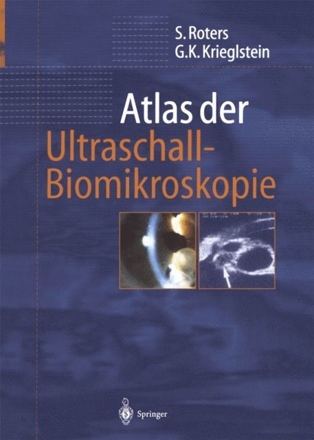Gunter K. Krieglstein, Sigrid Roters - Atlas der Ultraschall-Biomikroskopie, E-bok