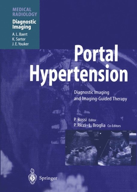 Plinio Rossi - Portal Hypertension, E-bok