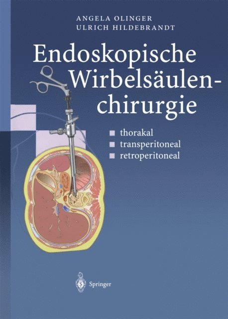Ulrich Hildebrandt, Angela Olinger - Endoskopische Wirbelsäulenchirurgie, E-bok