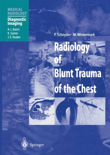 M. Wintermark, P. Schnyder - Radiology of Blunt Trauma of the Chest, E-bok