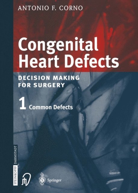 Antonio F. Corno - Congenital Heart Defects, E-bok. Tillgänglighet: Lägg i varukorg