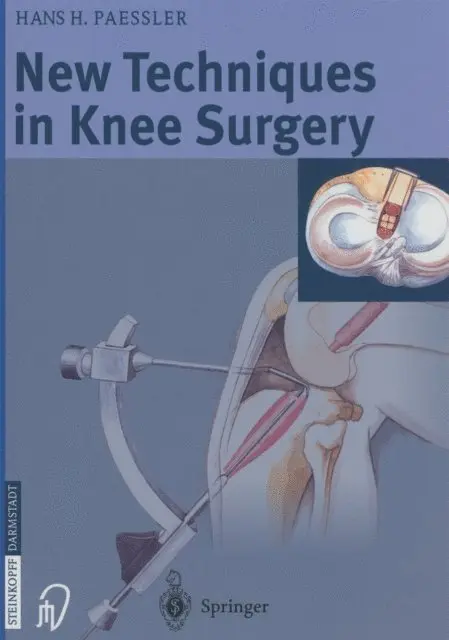 H.H. Paessler - New Techniques in Knee Surgery, E-bok. Tillgänglighet: Lägg i varukorg