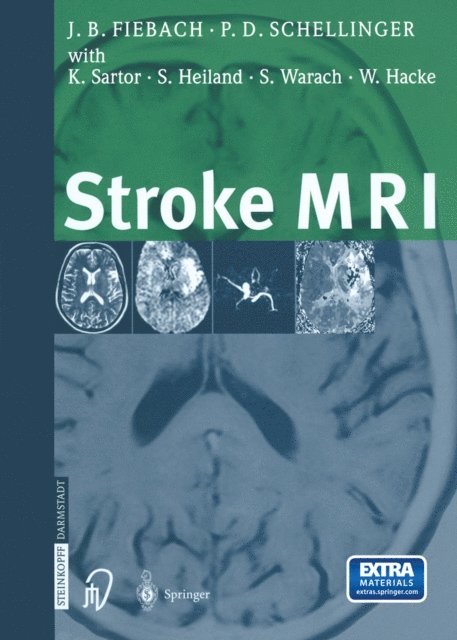 Peter Schellinger, Jochen Fiebach - Stroke MRI, E-bok