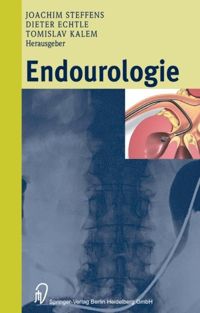 Tomislav Kalem, Dieter Echtle, Joachim Steffens - Endourologie, E-bok