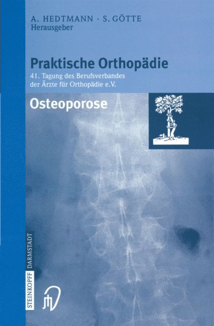 Siegfried Gotte, Achim Hedtmann - Osteoporose, E-bok. Tillgänglighet: Lägg i varukorg
