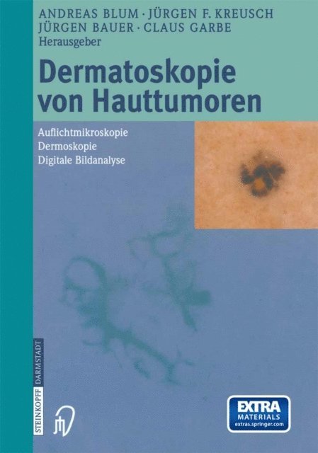 C. Garbe, J. Bauer, J.F. Kreusch, A. Blum - Dermatoskopie von Hauttumoren, E-bok