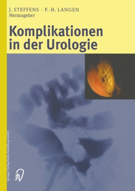 Paul-Heinz Langen, Joachim Steffens - Komplikationen in der Urologie, E-bok