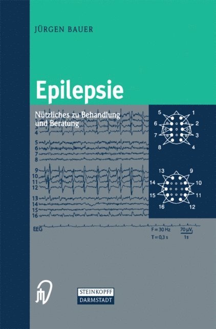 Jurgen Bauer - Epilepsie, E-bok