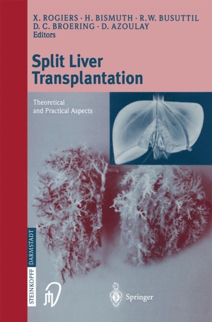 D. Azoulay, D.C. Broering, R.W. Busuttil, H. Bismuth, X. Rogiers - Split liver transplantation, E-bok