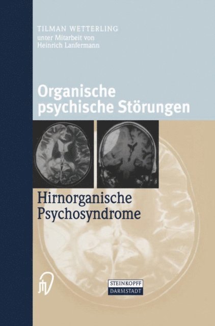 Tilman Wetterling - Organische psychische Störungen, E-bok
