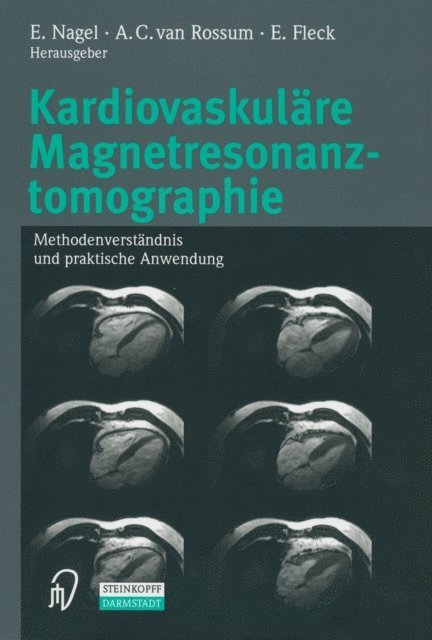 E. Fleck, A.C. van Rossum, E. Nagel - Kardiovaskuläre Magnetresonanztomographie, E-bok
