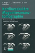 Kardiovaskulÿre Magnetresonanztomographie