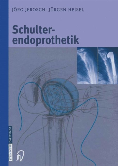 Jurgen Heisel, Jorg Jerosch - Schulterendoprothetik, E-bok