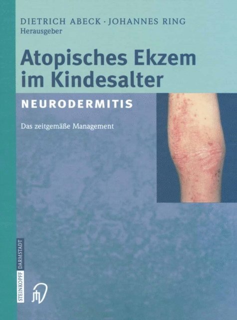 J. Ring, D. Abeck - Atopisches Ekzem im Kindesalter (Neurodermitis), E-bok