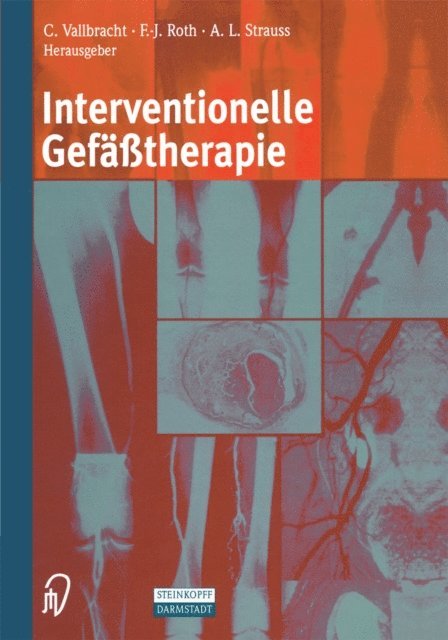 A.L. Strauss, F.-J. Roth, C. Vallbracht - Interventionelle Gefäßtherapie, E-bok