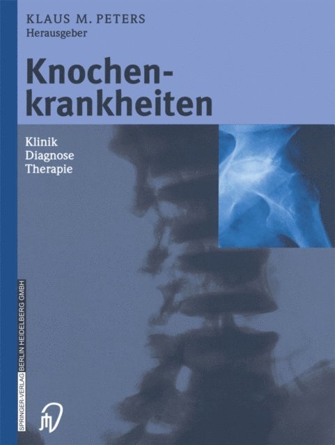 Klaus M. Peters - Knochenkrankheiten, E-bok
