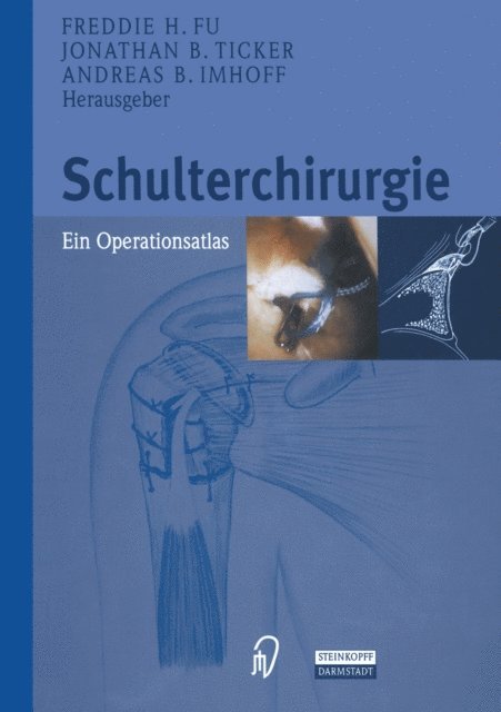 A.B. Imhoff, J.B. Ticker, F.H. Fu - Schulterchirurgie, E-bok