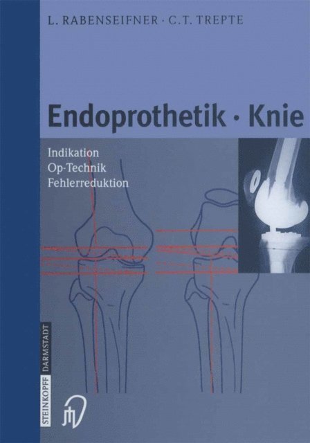 C. Trepte, L. Rabenseifner - Endoprothetik Knie, E-bok. Tillgänglighet: Lägg i varukorg