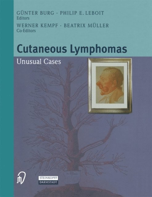 P.E. LeBoit, G. Burg - Cutaneous Lymphomas, E-bok