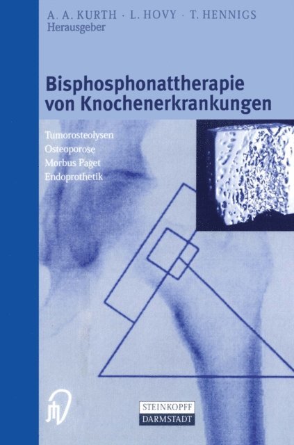 T. Hennigs, L. Hovy, A.A. Kurth - Bisphosphonattherapie von Knochenerkrankungen, E-bok