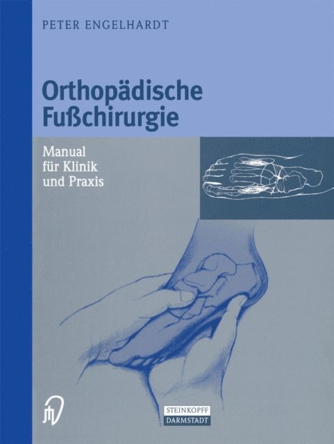 Peter Engelhardt - Orthopädische Fußchirurgie, E-bok