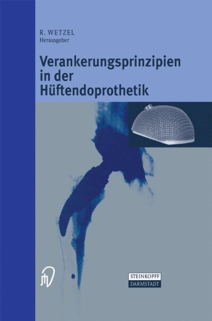 Roland Wetzel - Verankerungsprinzipien in der Hüftendoprothetik, E-bok