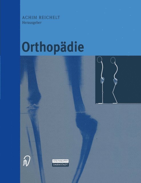 Achim Reichelt - Orthopädie, E-bok. Tillgänglighet: Lägg i varukorg