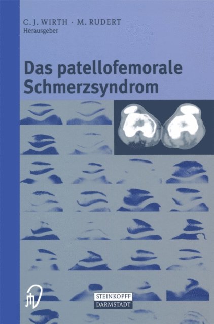 M. Rudert, C.J. Wirth - Das patellofemorale Schmerzsyndrom, E-bok. Tillgänglighet: Lägg i varukorg