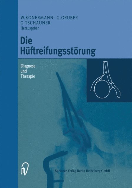 Christian Tschauner, Gerd Gruber, Werner Konermann - Die Hüftreifungsstörung, E-bok