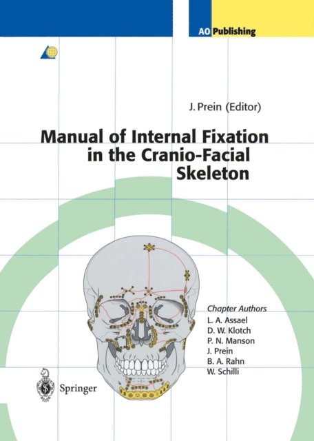 Joachim Prein - Manual of Internal Fixation in the Cranio-Facial Skeleton, E-bok
