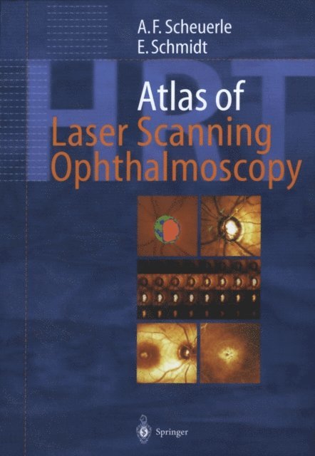Eckart Schmidt, Alexander Friedrich Scheuerle - Atlas of Laser Scanning Ophthalmoscopy, E-bok