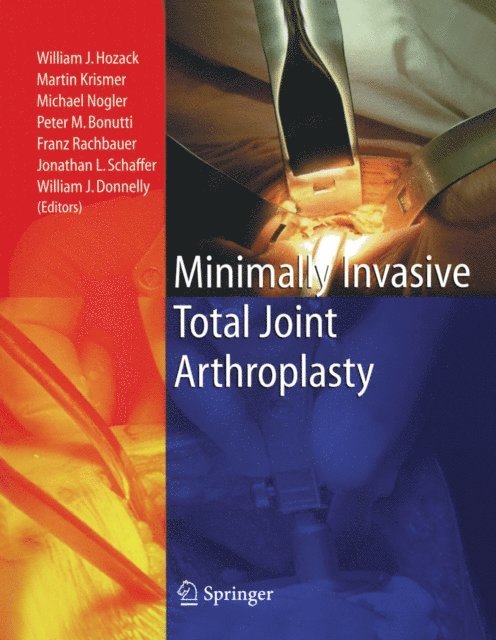 William J. Donnelly, Jonathan L. Schaffer, Franz Rachbauer, Peter M. Bonutti, Michael Nogler, Martin Krismer, William J. Hozack - Minimally Invasive Total Joint Arthroplasty, E-bok